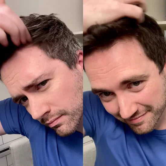 Carlos M. – 42 años, Caracas